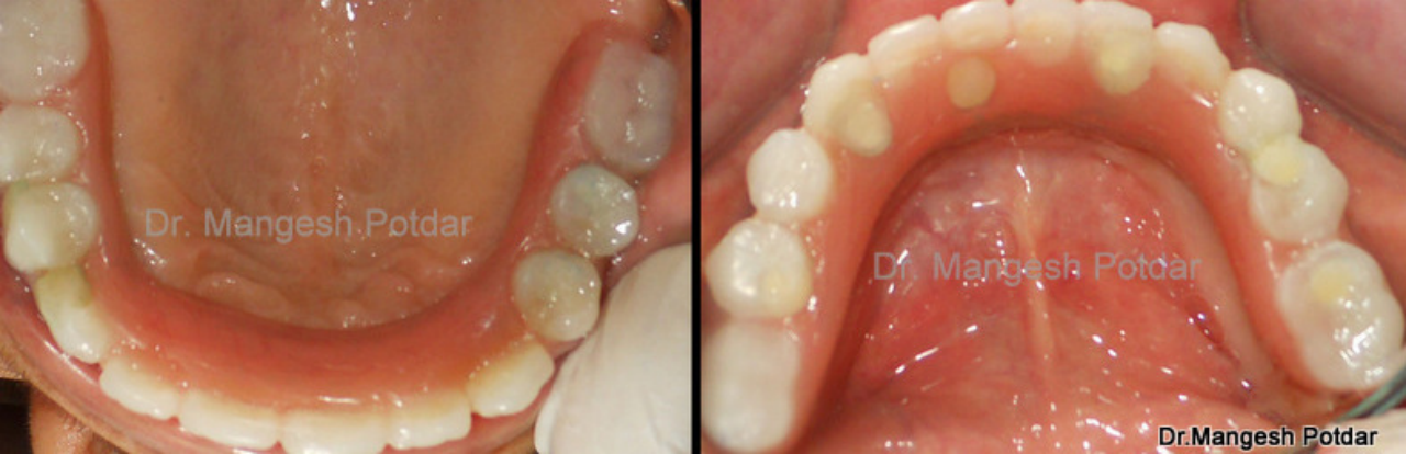 Implant Dentistry Implant Dentistry