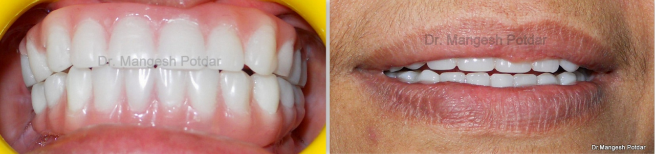 Implant Dentistry Implant Dentistry